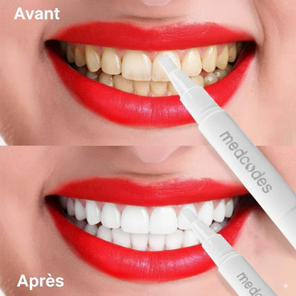 Stylo Gel de Blanchiment Dentaire – Retrouver un sourire éclatant en quelques jours